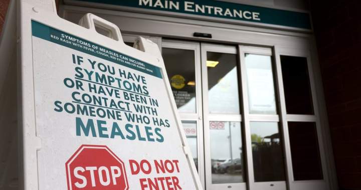 Canada has most measles cases in North America: Health Group Canada has most measles cases in north america: health group