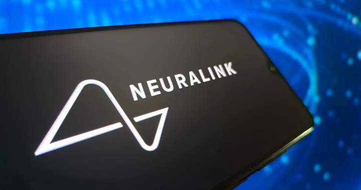 2 Toronto Hospital patients get Elon Musk's neural implants at No. 1 in Canada 2 toronto hospital patients get elon musk's neural implants at