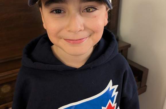 Boy's prosthetic eye shows his love for the Jays Boy's prosthetic eye shows his love for the jays